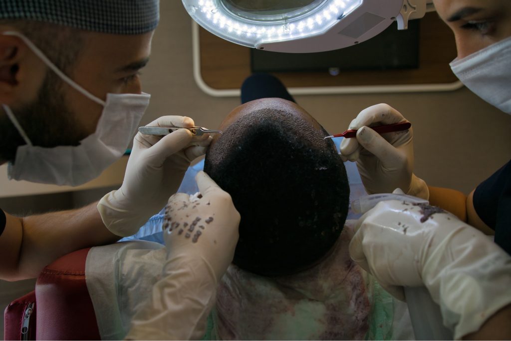 istanbul hair transplant